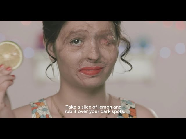 #ACID ATTACK Beauty Tips by Reshma: How to get rid of dark spots naturally