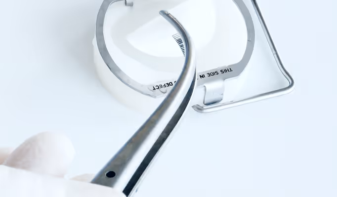 Illustration eines Knies mit hervorgehobener Kniescheibe und Bändern.