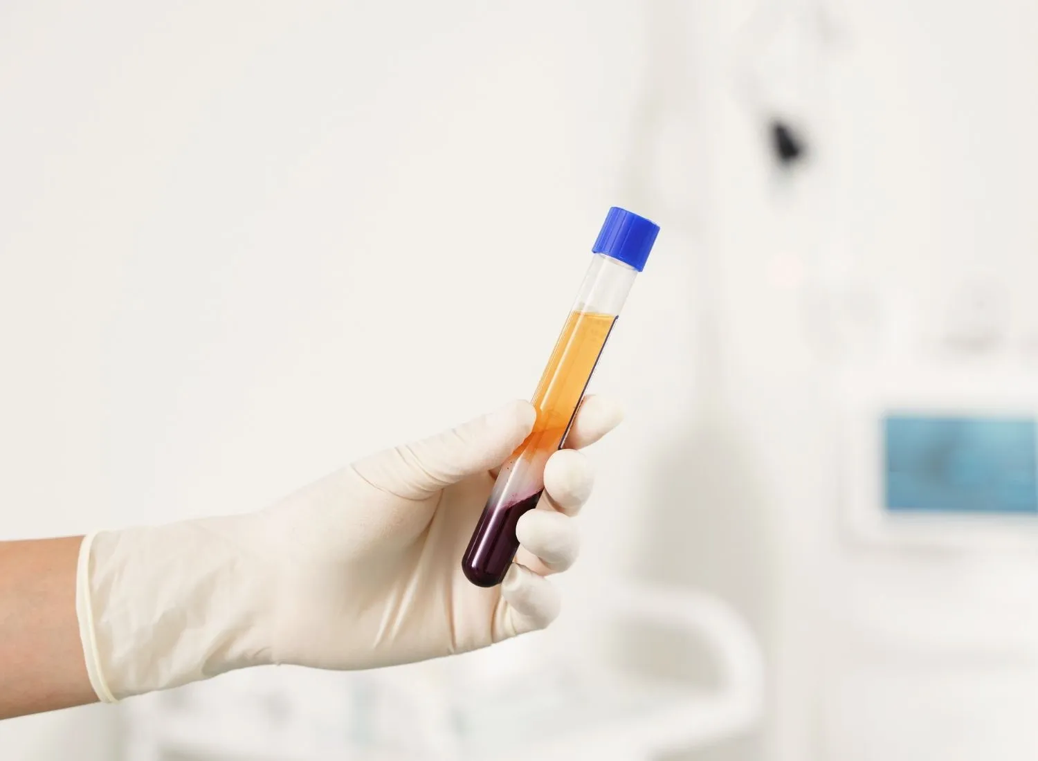 Gloved hand holding test tube with separated blood layers, plasma on top and red cells below.