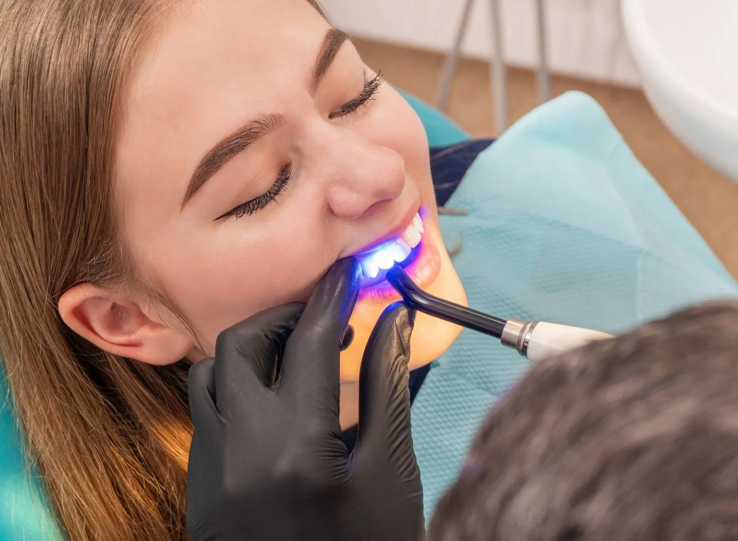 Dentist wearing black gloves using a blue curing light on a smiling patient's teeth.