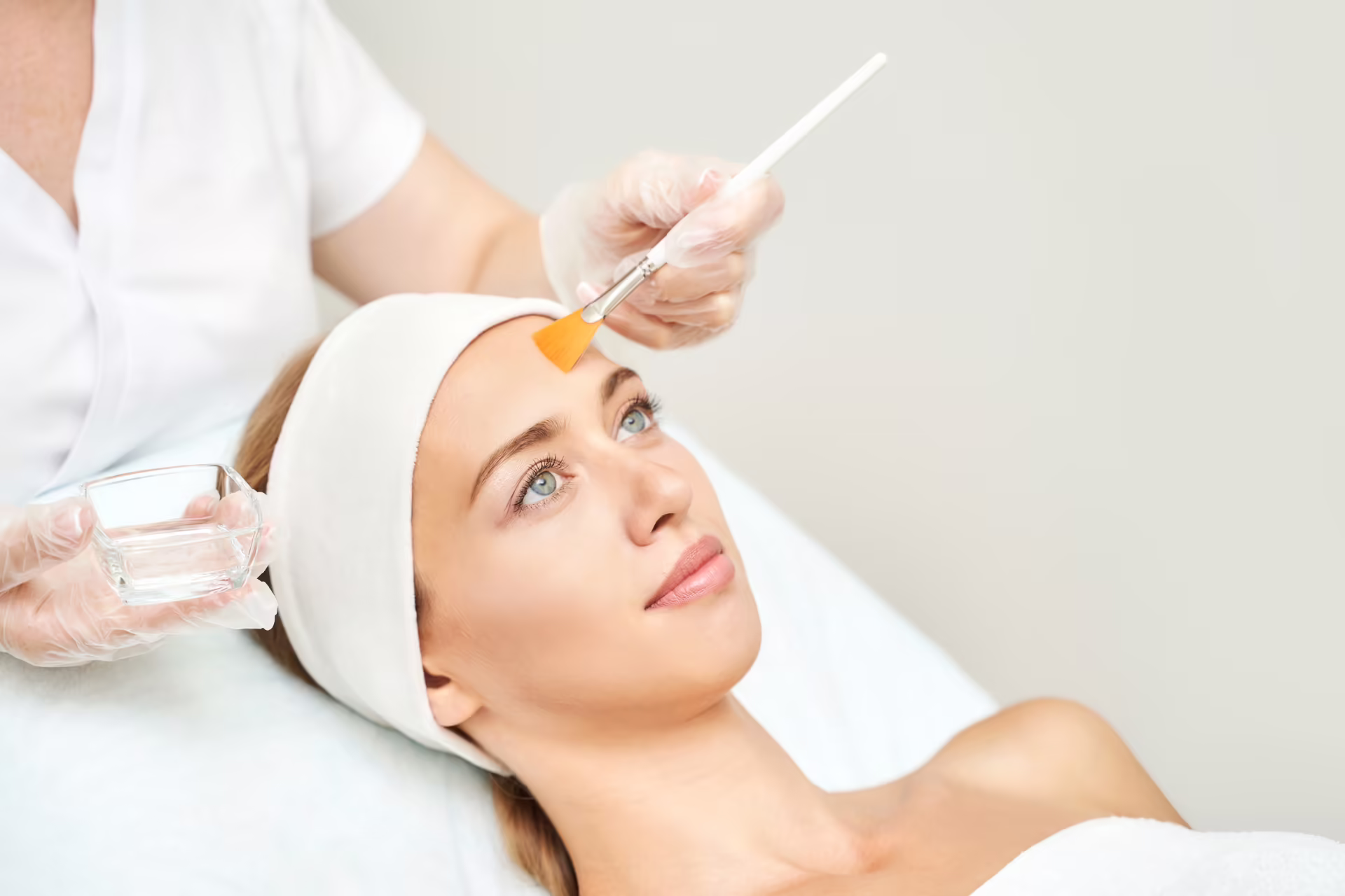 Chemický peeling