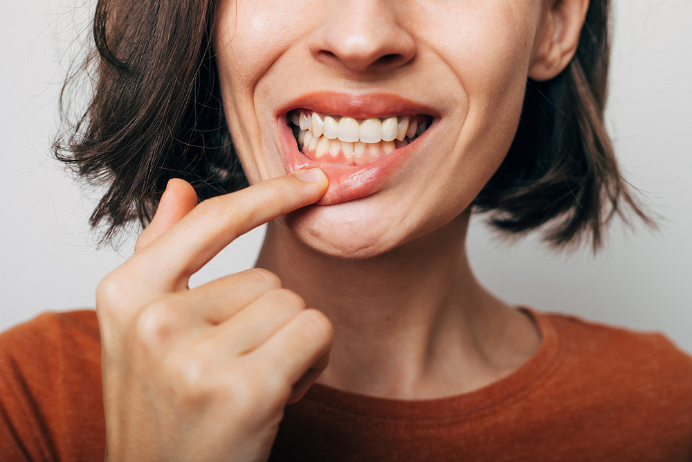 Bone Grafting in Shelton, CT