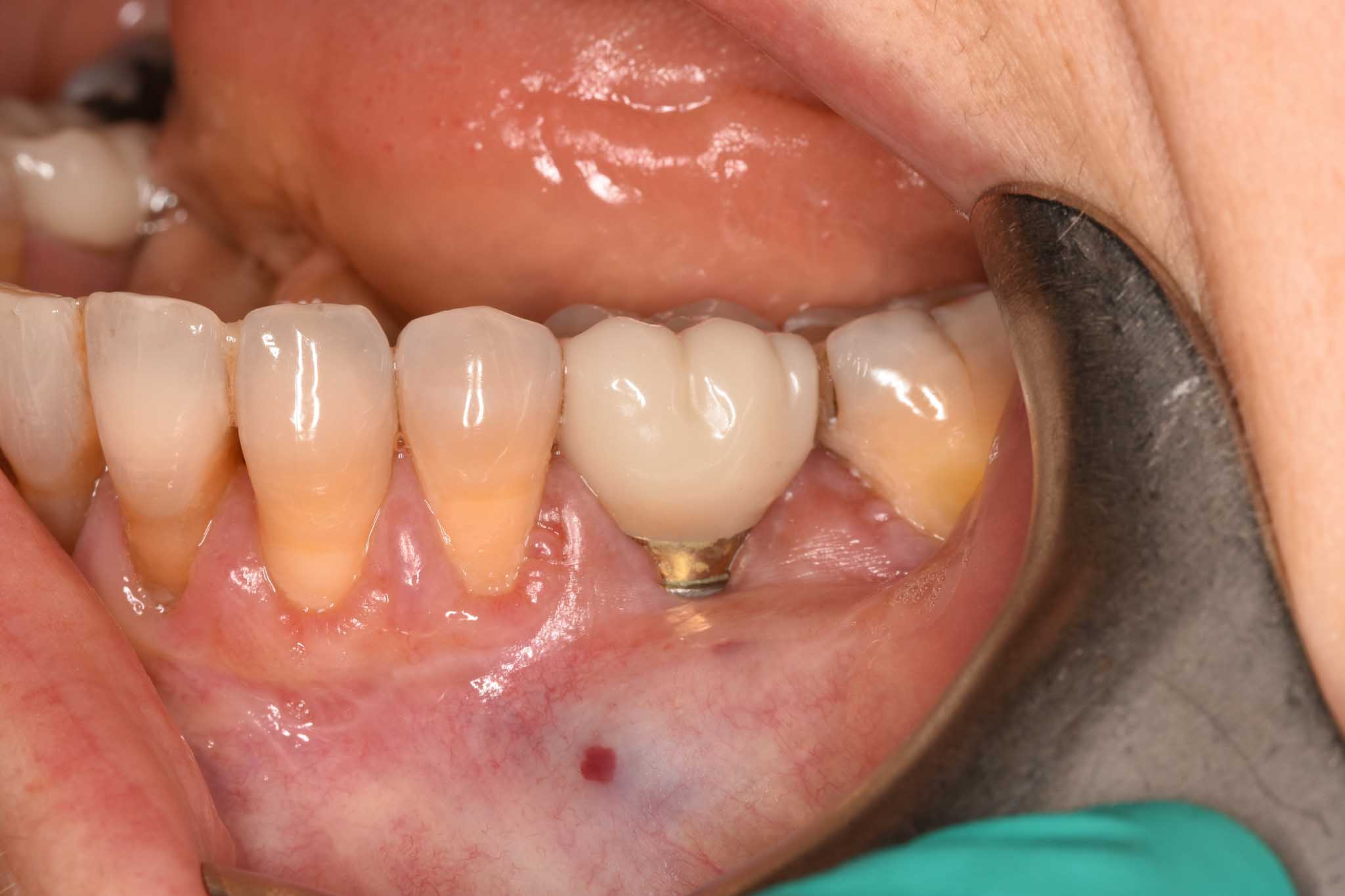 Before Image