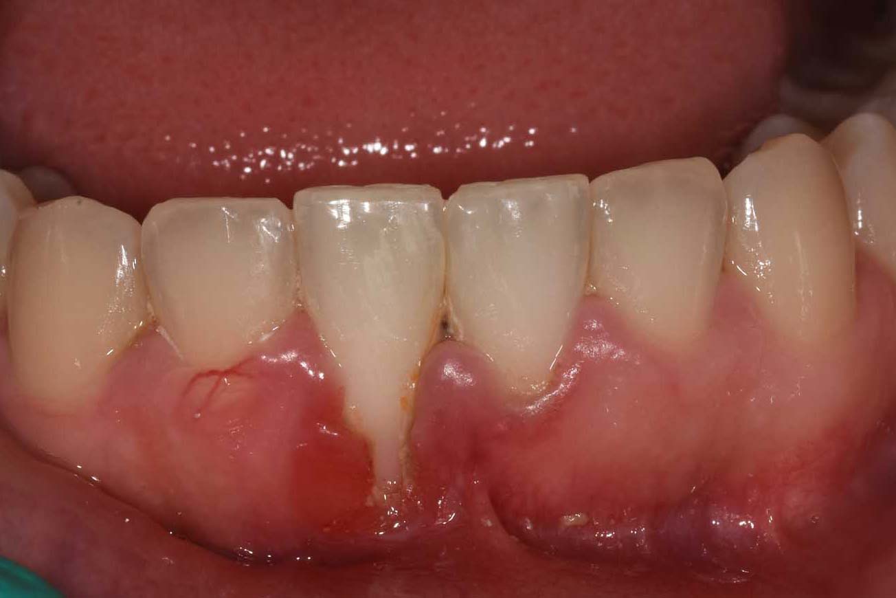 Before Image
