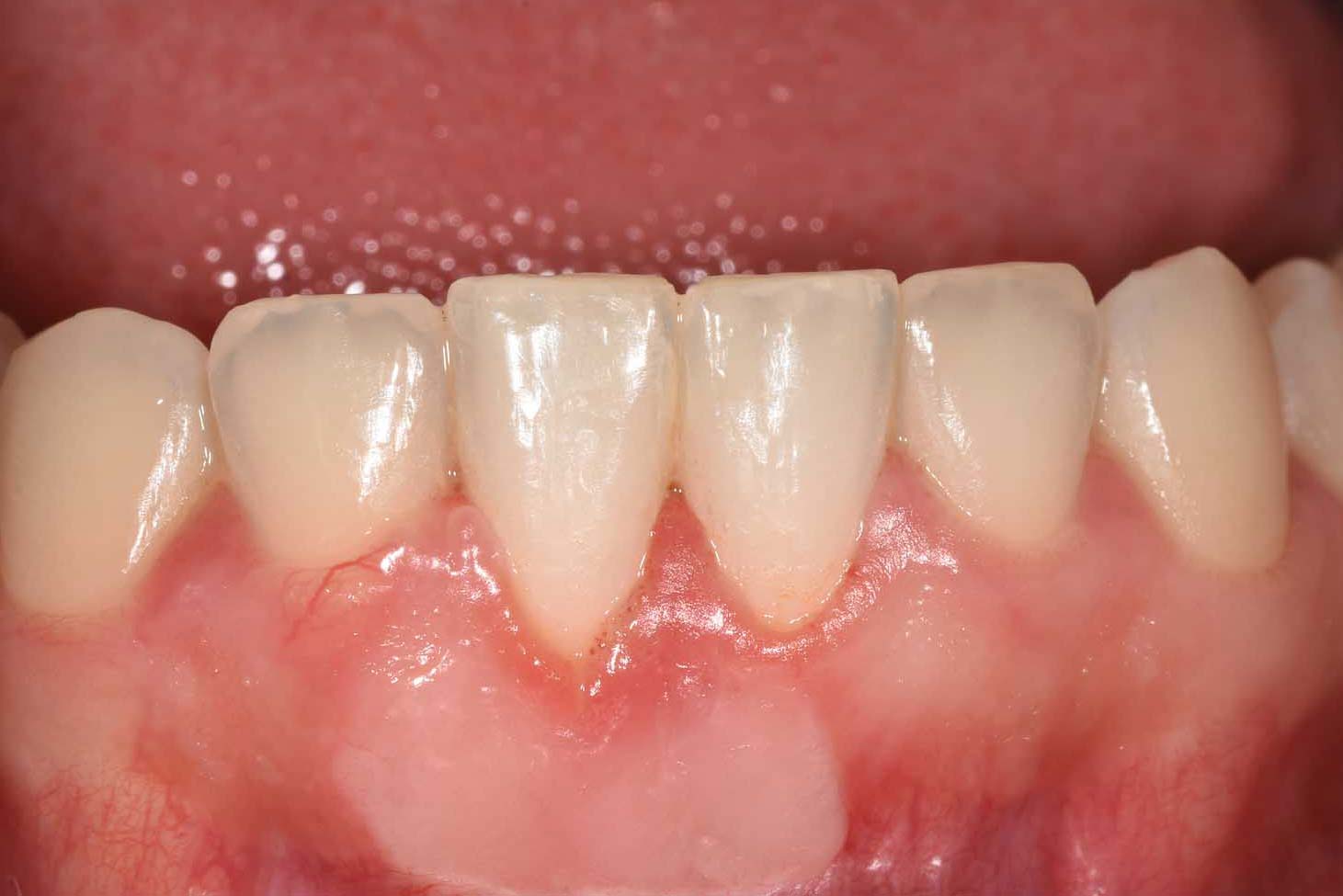 After Image