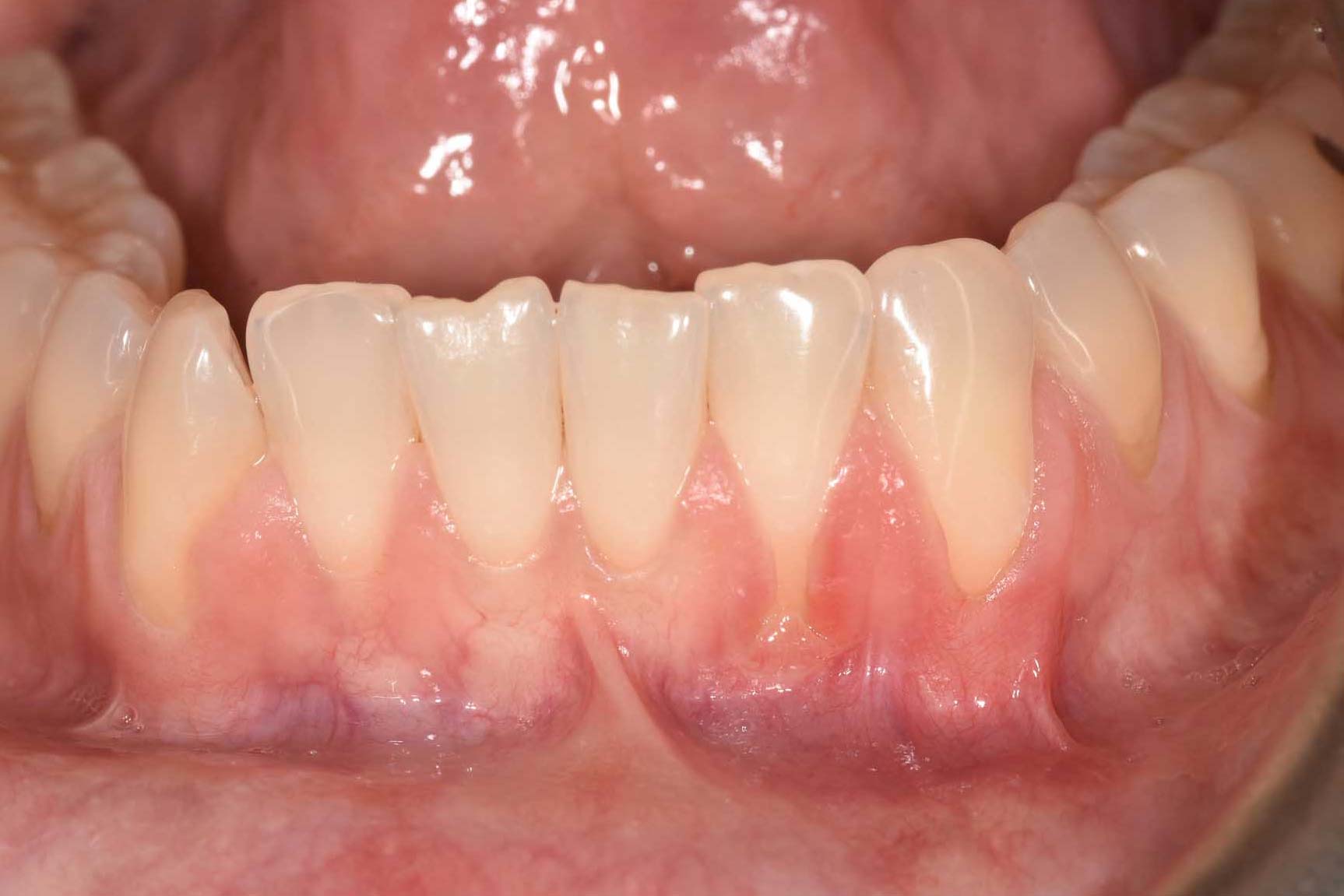 Before Image