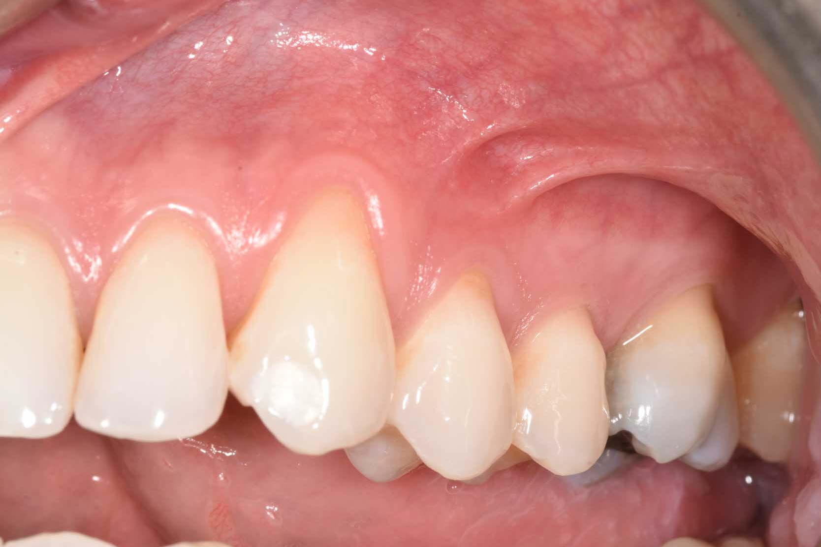 Before Image
