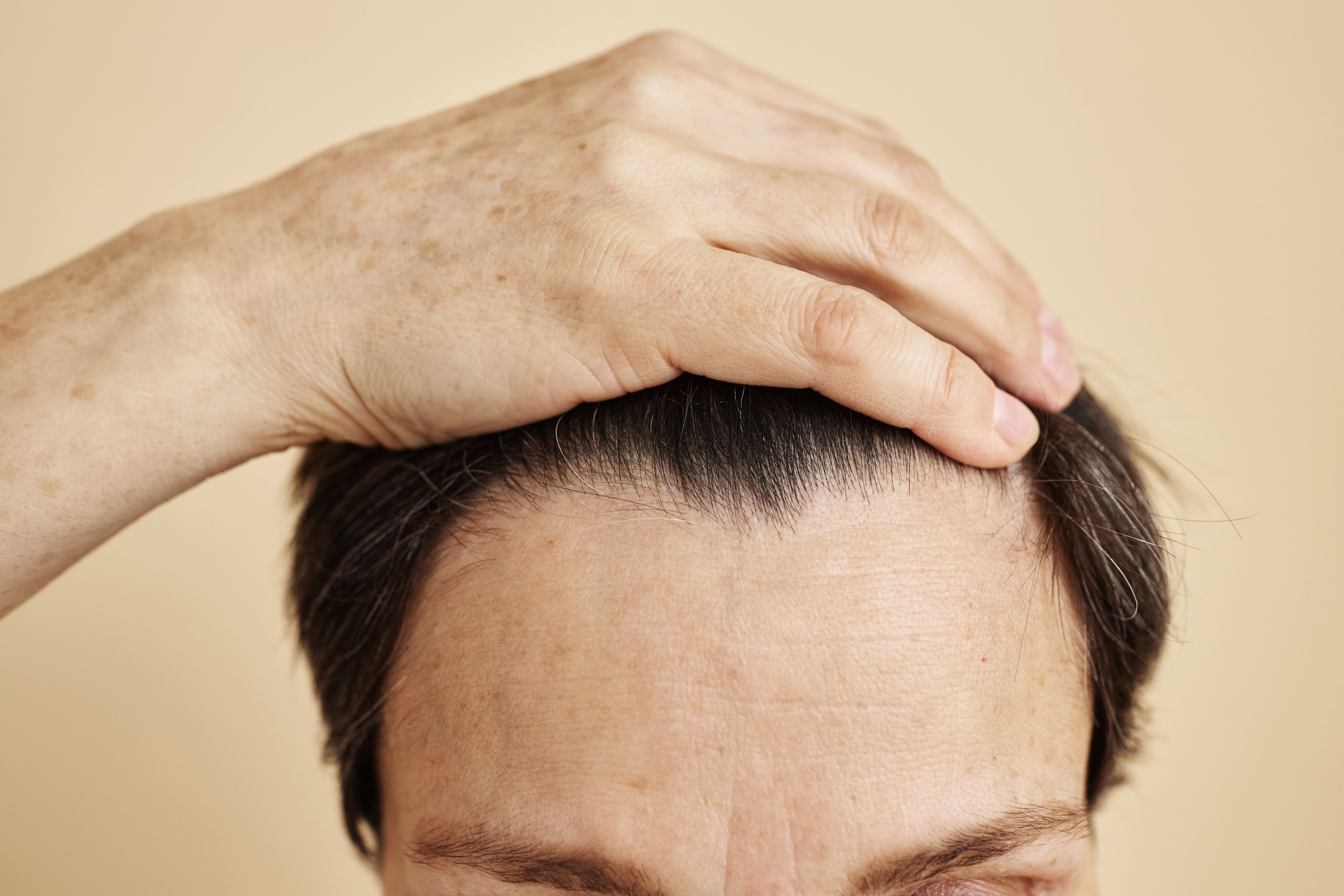 smiling man with full head of hair and thick density in Maryland
