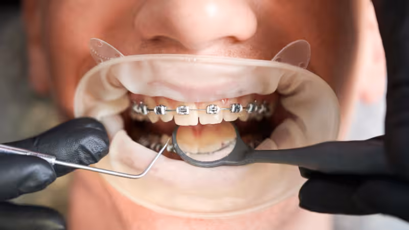 orthodontic surgery