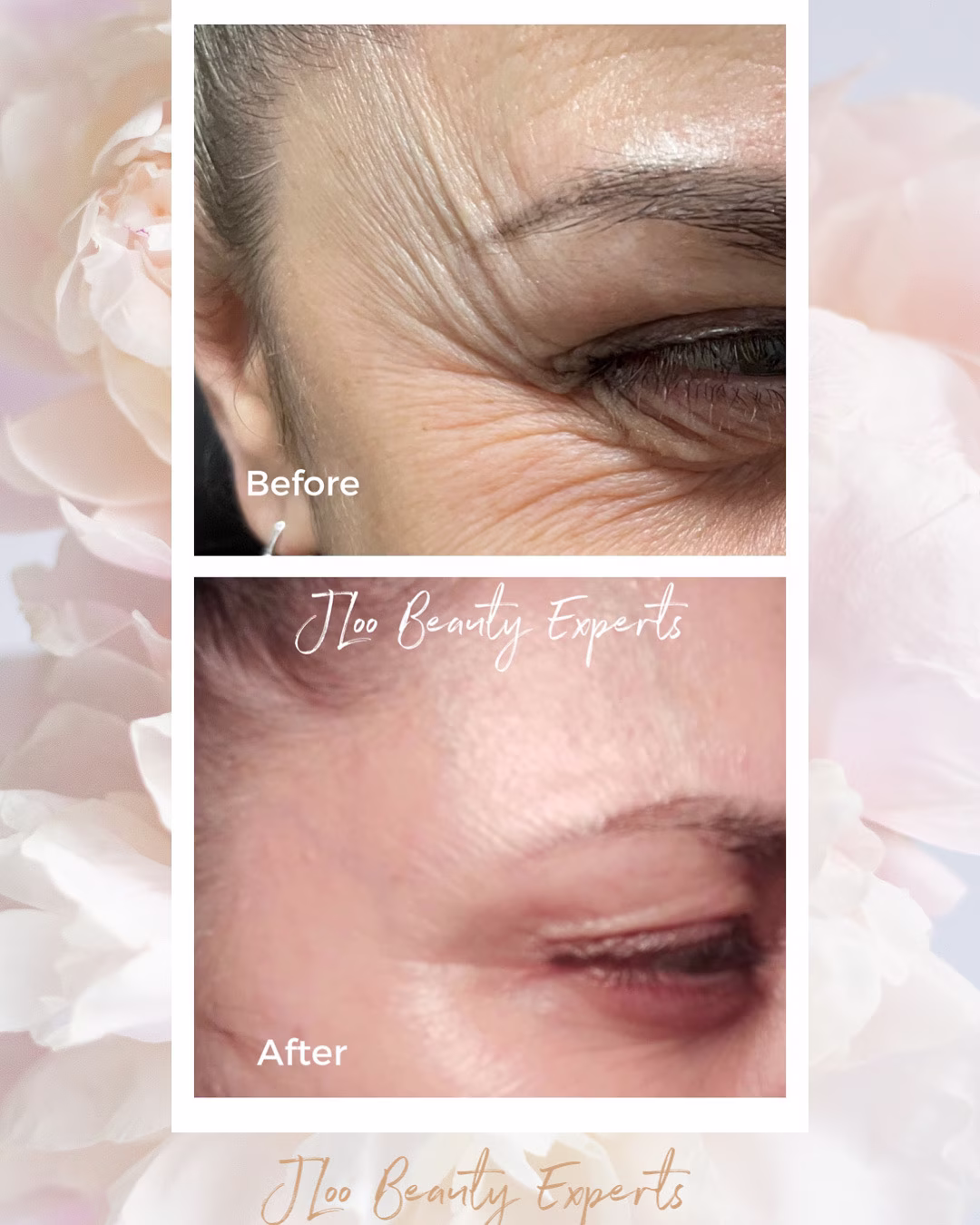 JLoo Beauty Experts clinic gallery, Midtown Manhattan medspa