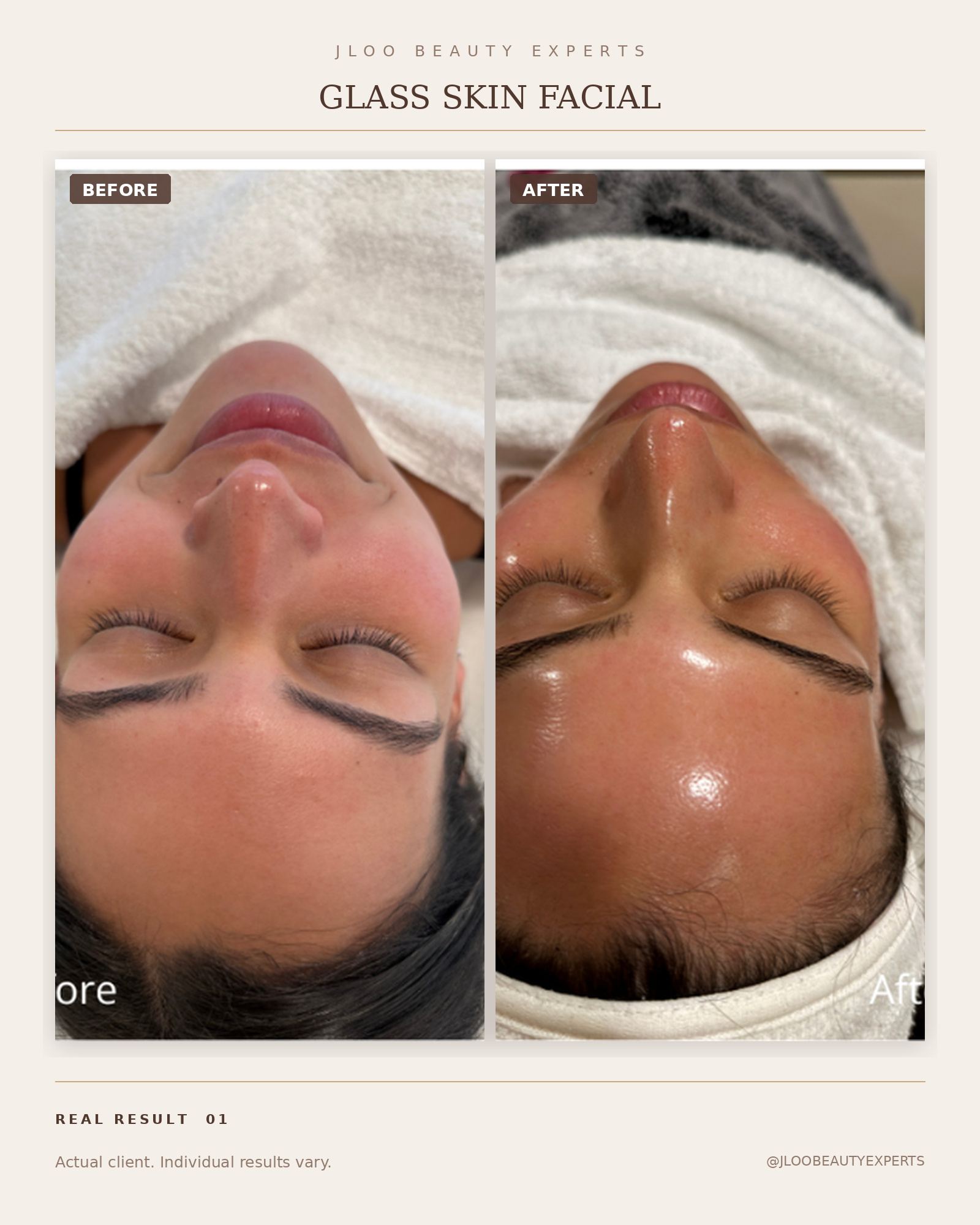 Fall Skin Rejuvenation in NYC: Our Seasonal Treatment Guide