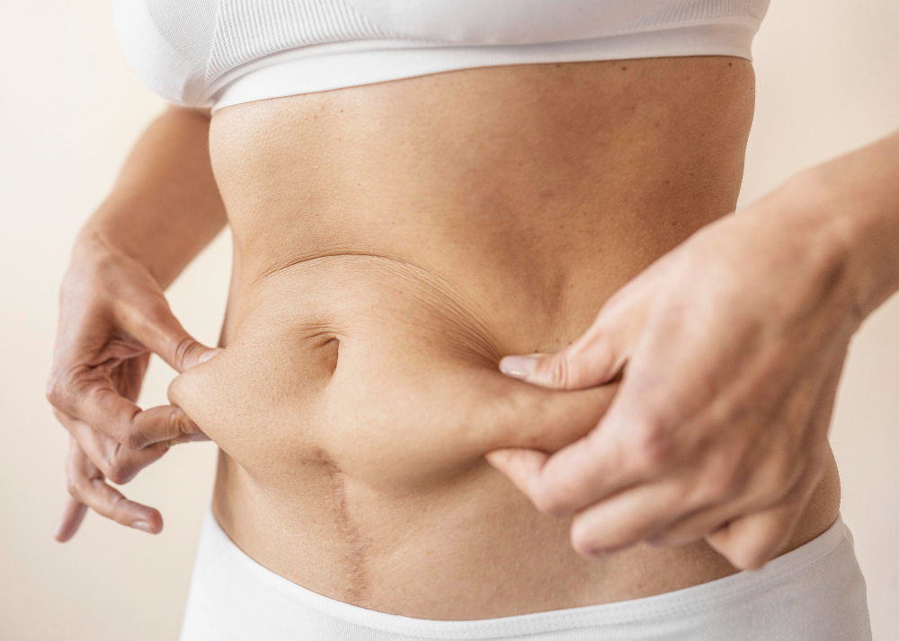 Woman pinching loose skin around her navel