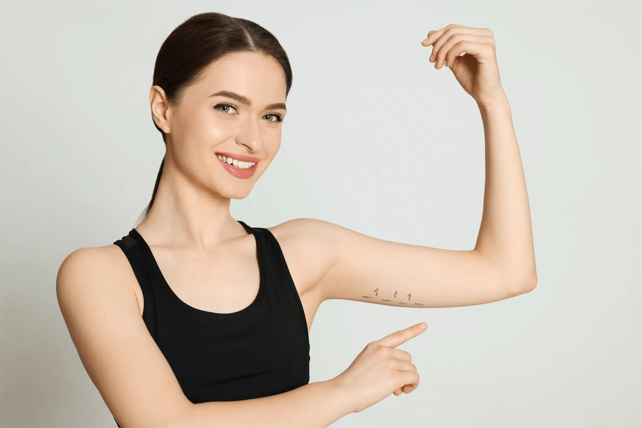 Smiling woman in a black tank top pointing to marked incision lines on her upper arm
