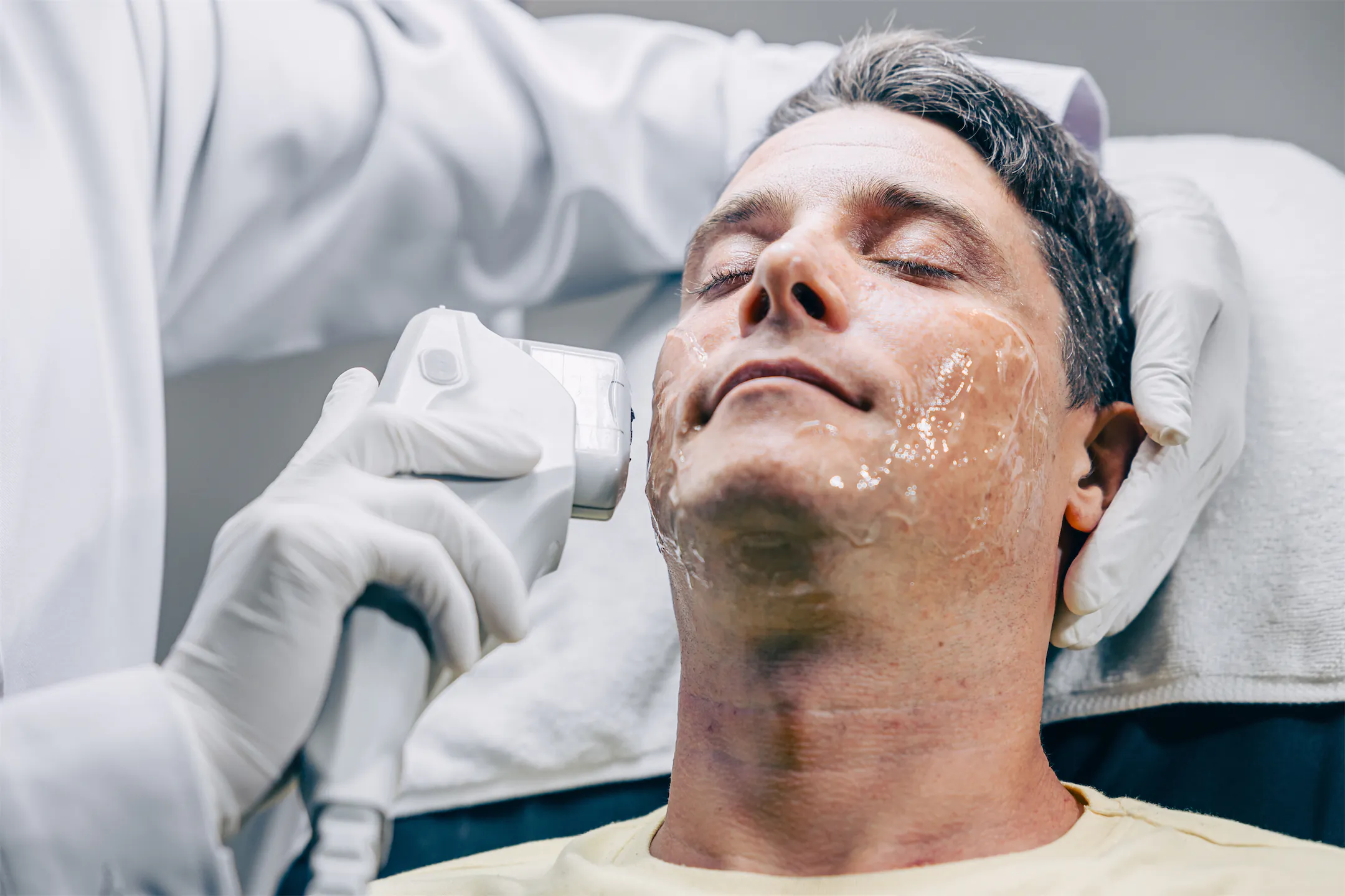 Gloved provider treating a man's face with an ultrasound handpiece and gel