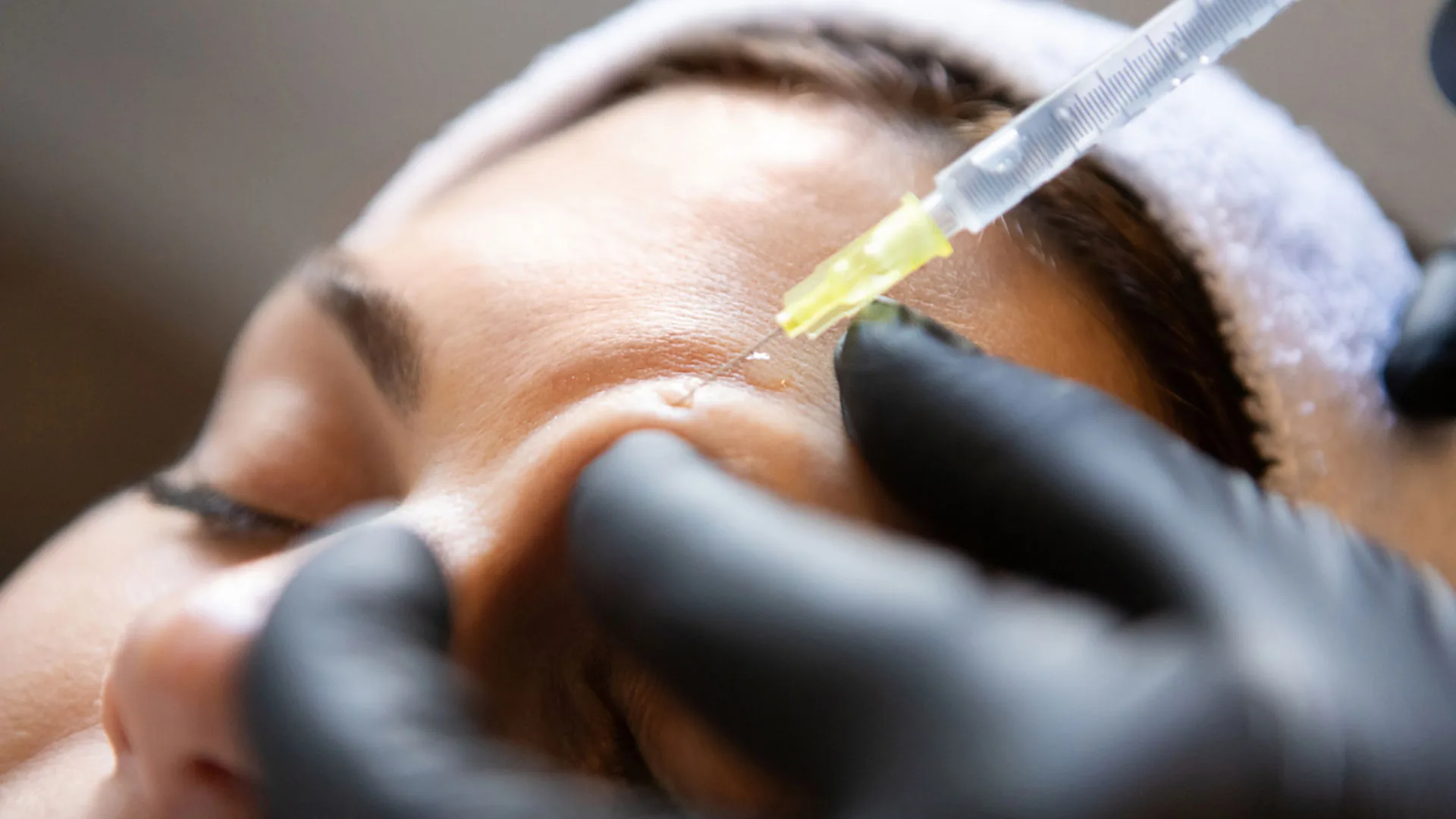 Gloved provider injecting a woman's forehead near the brow