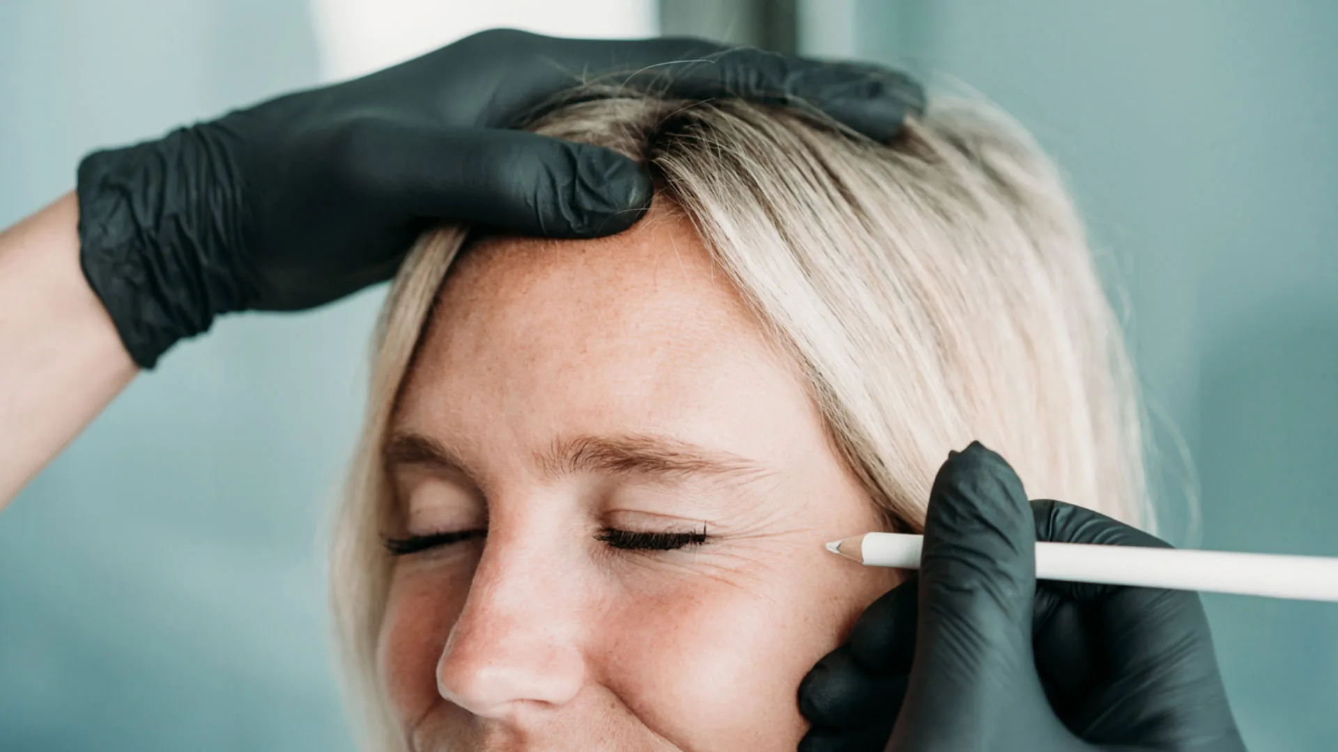 Gloved provider marking the skin near a woman's eye with a white pencil