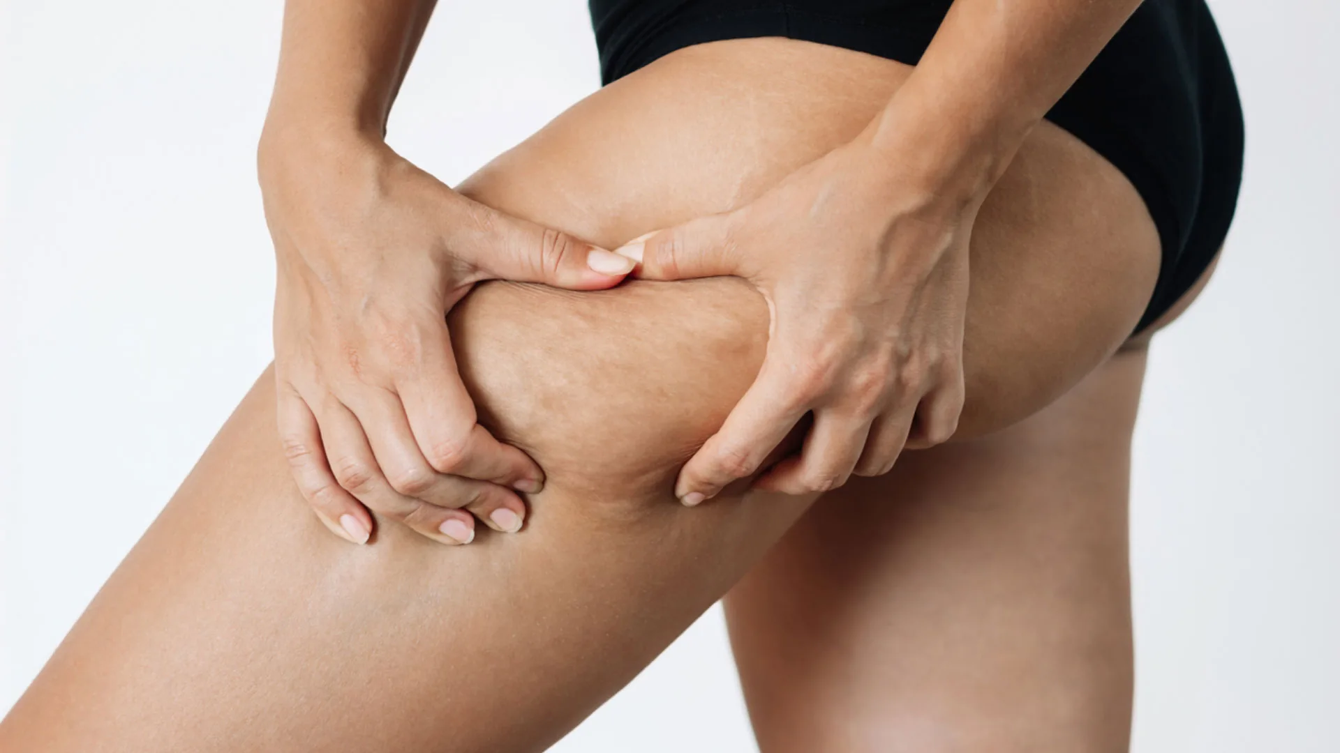 Woman pinching the skin on her upper thigh