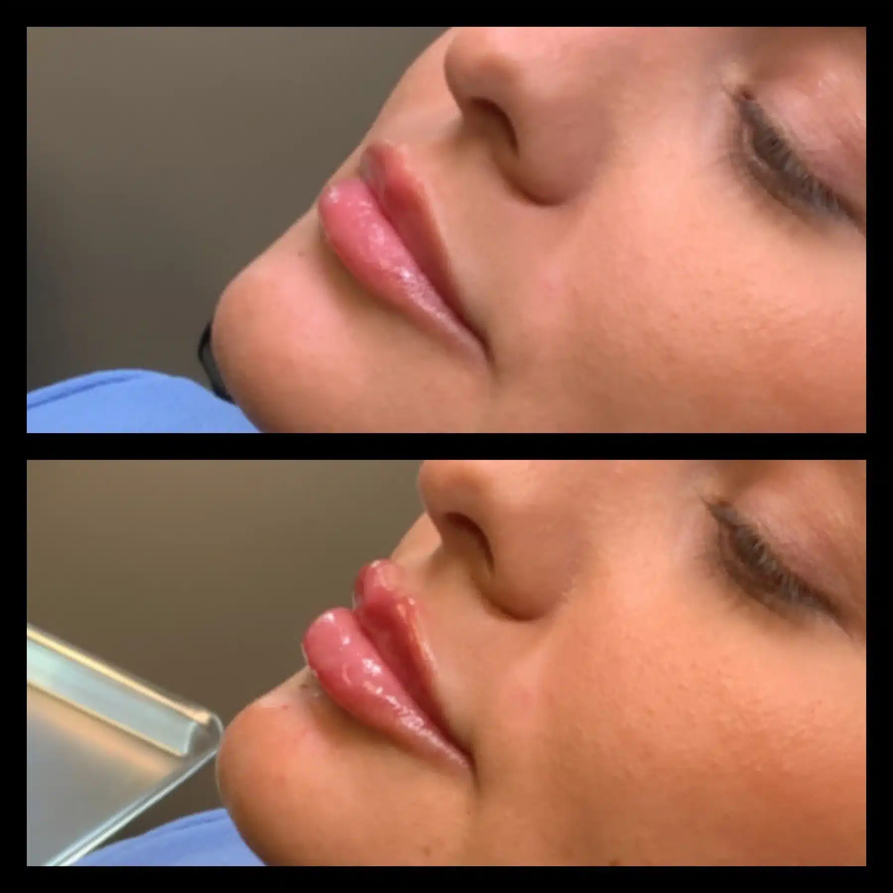 bougie lips 5