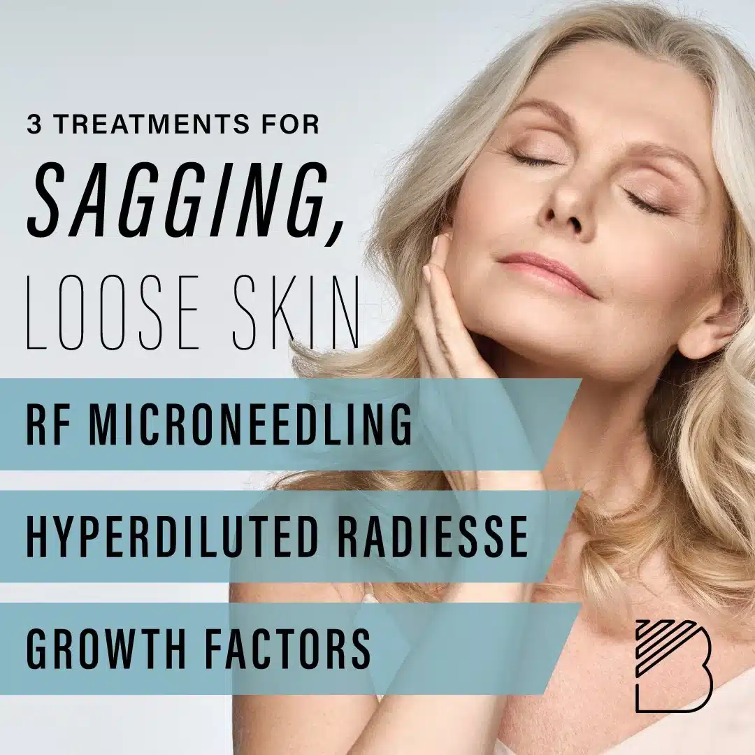 skin firming rf microneedling treatments near fort worth texas