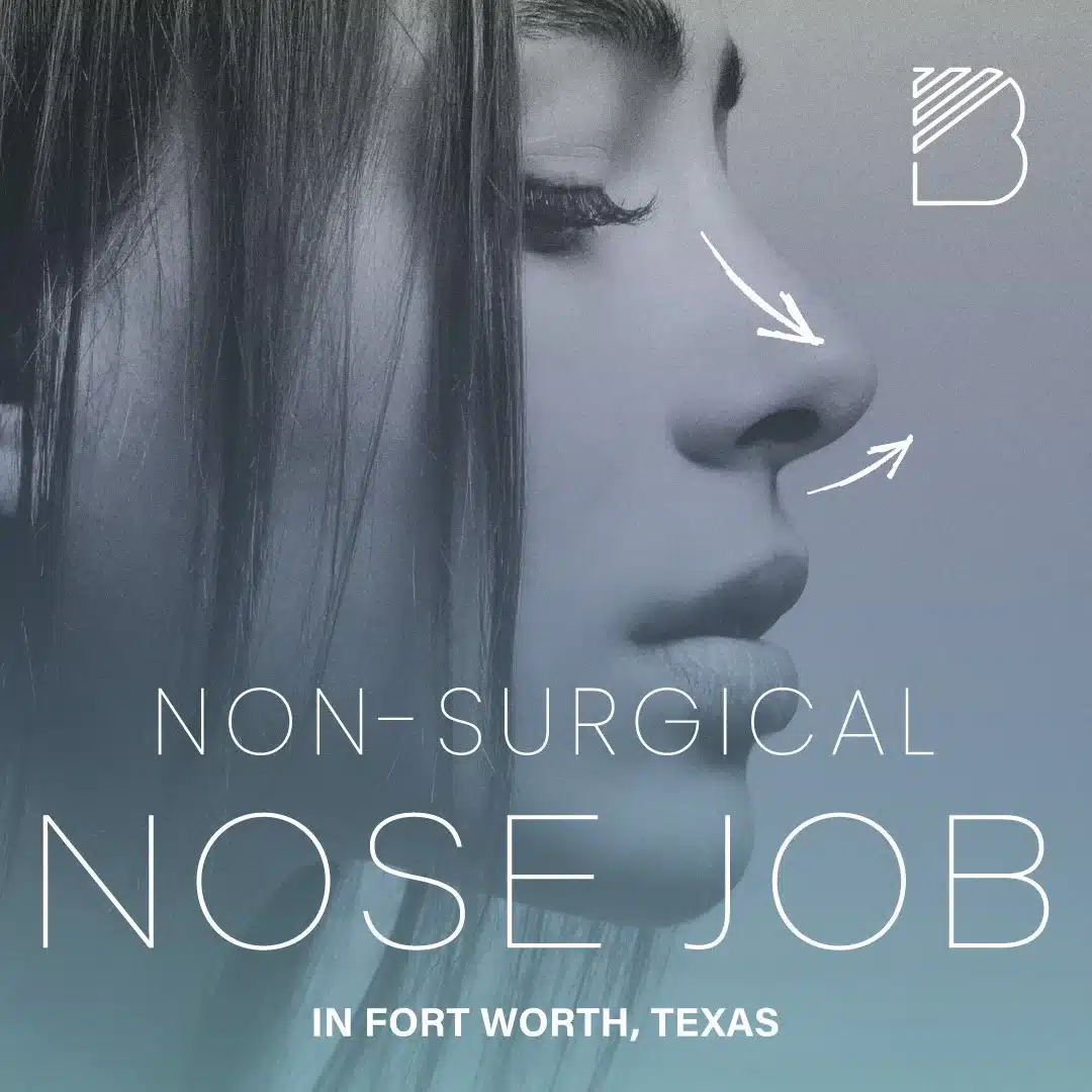 liquid rhinoplasty fort worth, texas