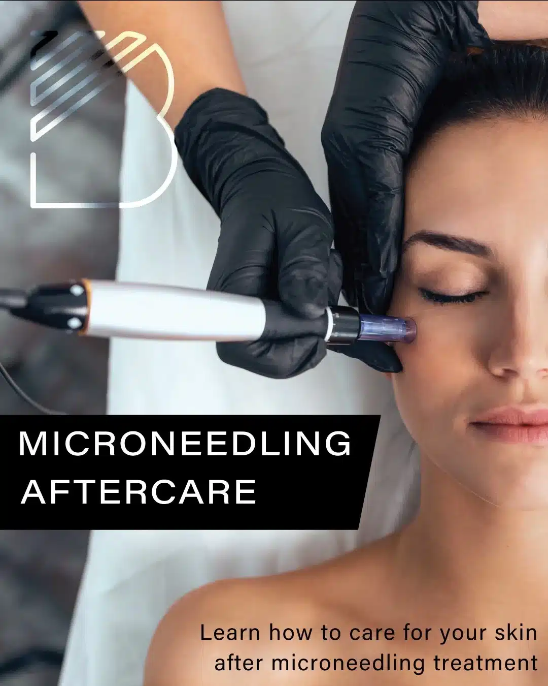 Microneedling aftercare 2 Bougie Aesthetics June 2024