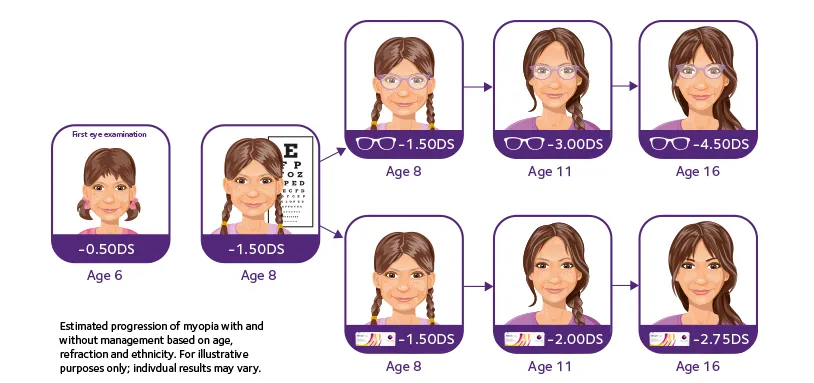 Diagram showing myopia progression in a girl from age 6 to 16 with and without management, including diopters.