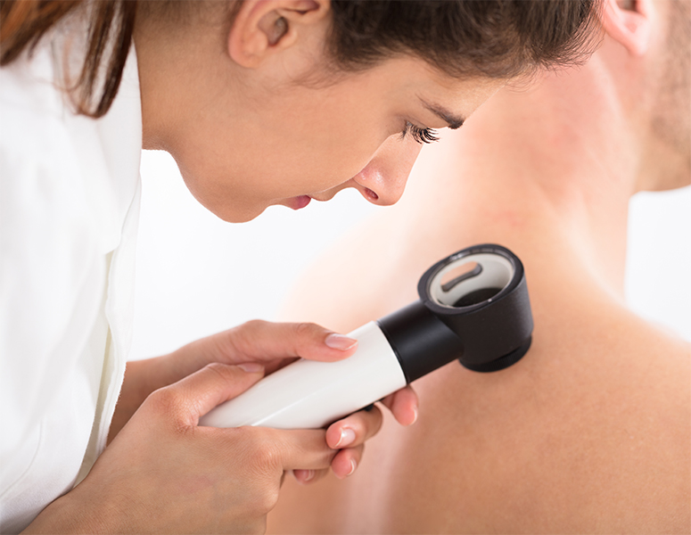 Skin cancer screening practitioner performing a professional skin check with a dermatoscope