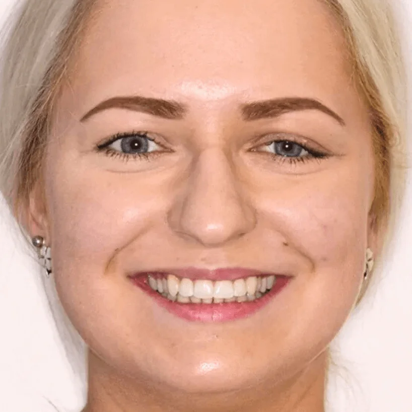 Close-up of a smiling woman with blonde hair, clear skin, and light eyes.