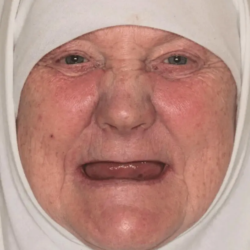 Close-up of an elderly person in a white head covering with eyes open and mouth slightly open showing tongue.