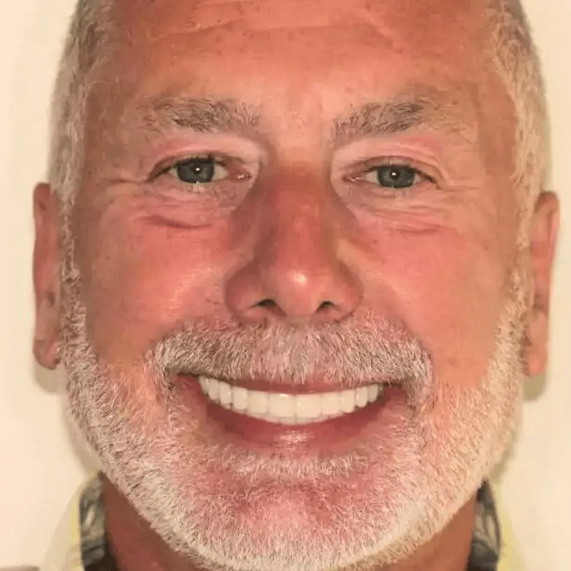 Close-up of a smiling older man with gray beard and short hair showing white teeth.