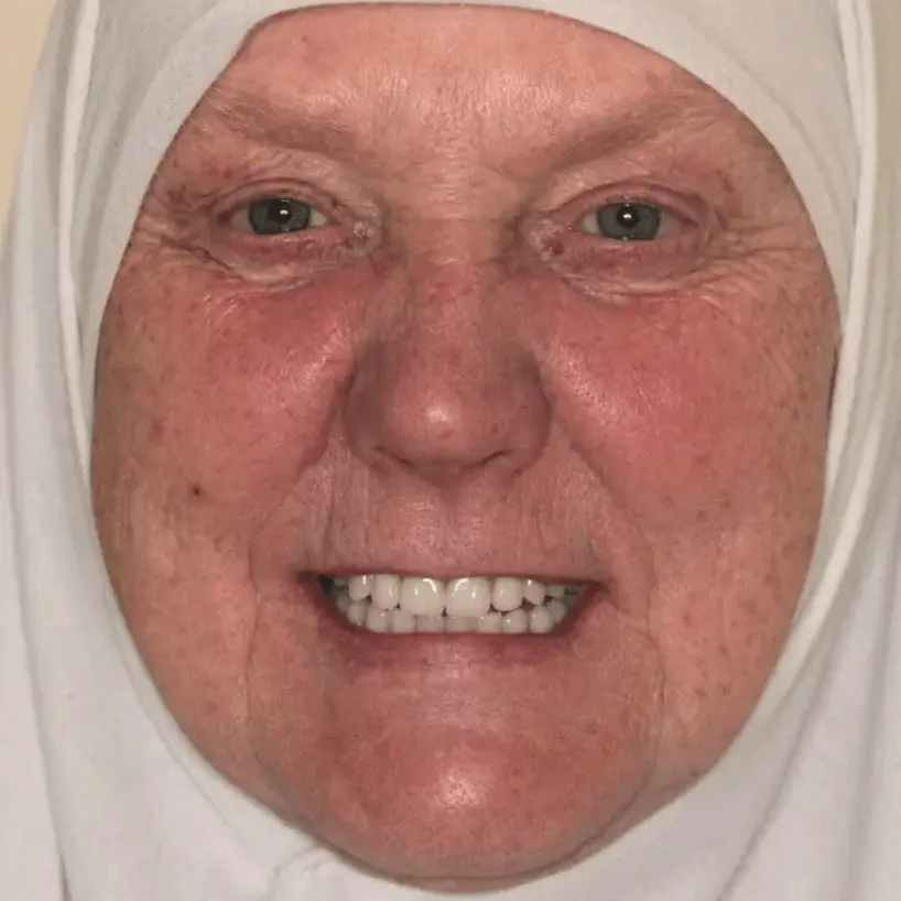 Close-up of an older woman wearing a white headscarf, smiling and showing her teeth.