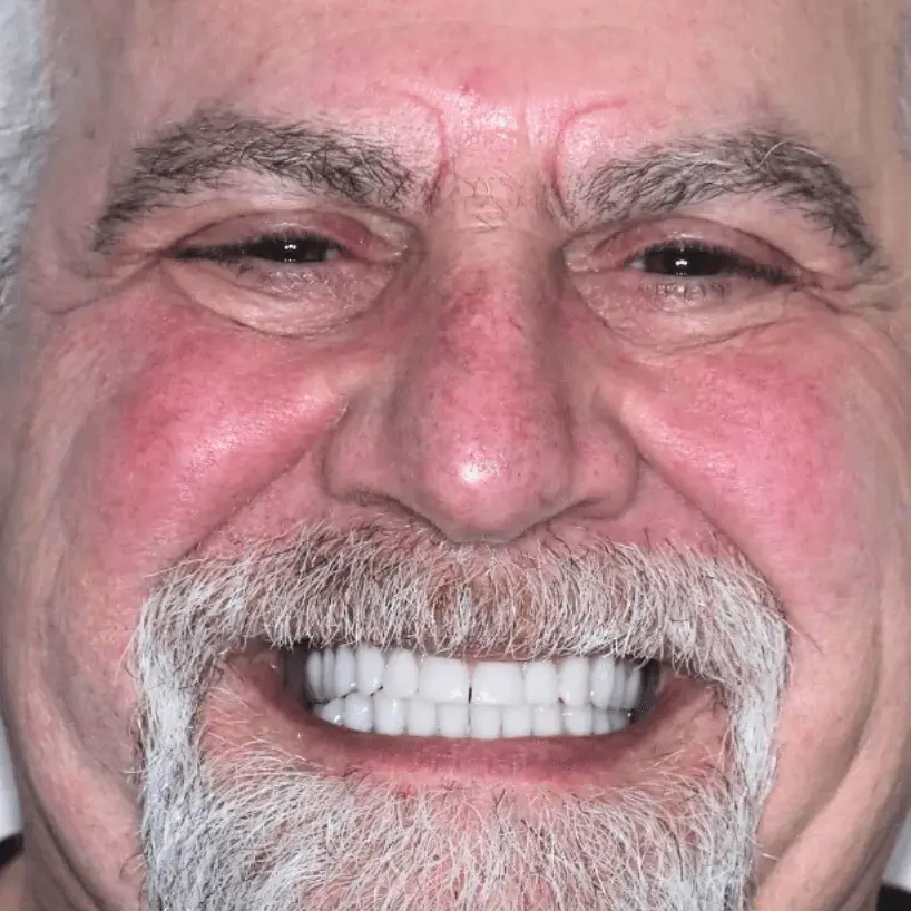 Close-up of an elderly man smiling with bright white teeth and gray facial hair.