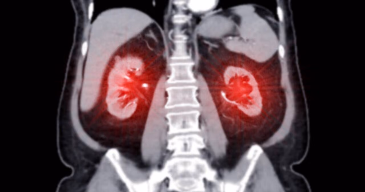Medical imaging contrast