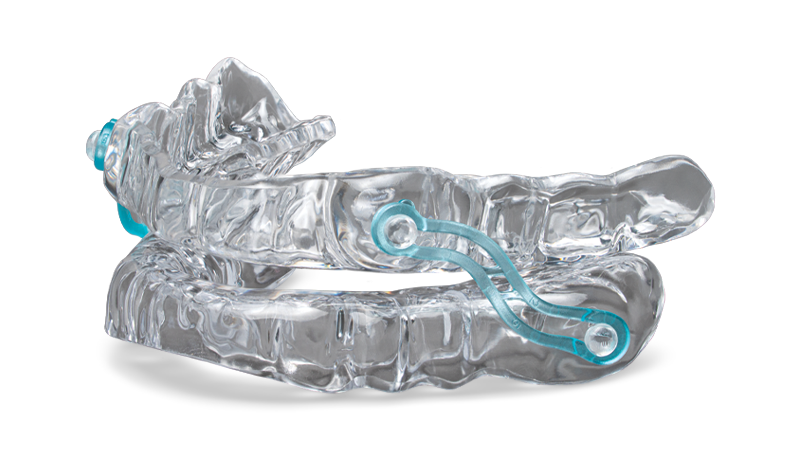 Oral appliance, a CPAP alternative