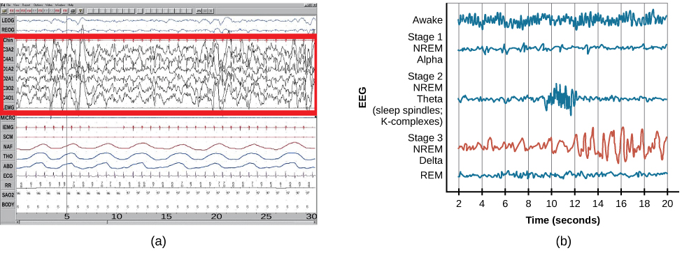 AP Psychology Unit 1: Brain wave patterns showing delta waves in deep sleep stage 3 and REM sleep brain activity