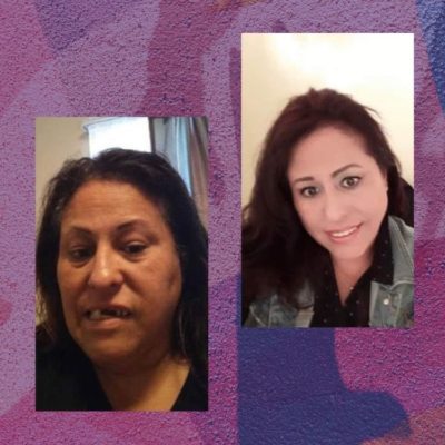 Two photos of a survivor sharing her story