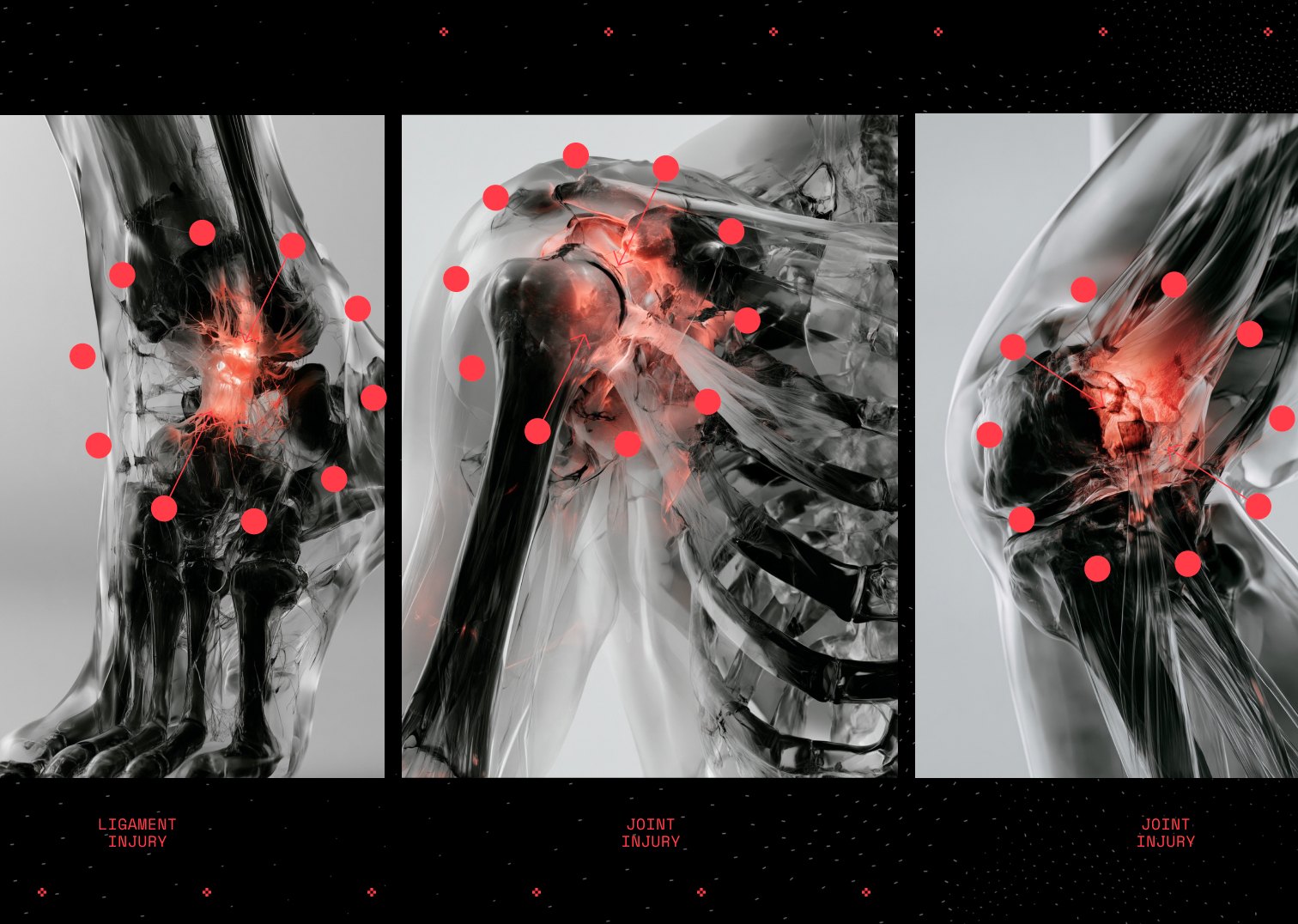 Three 3D renders of injured joints with damage highlighted in red, labelled ligament injury and joint injury