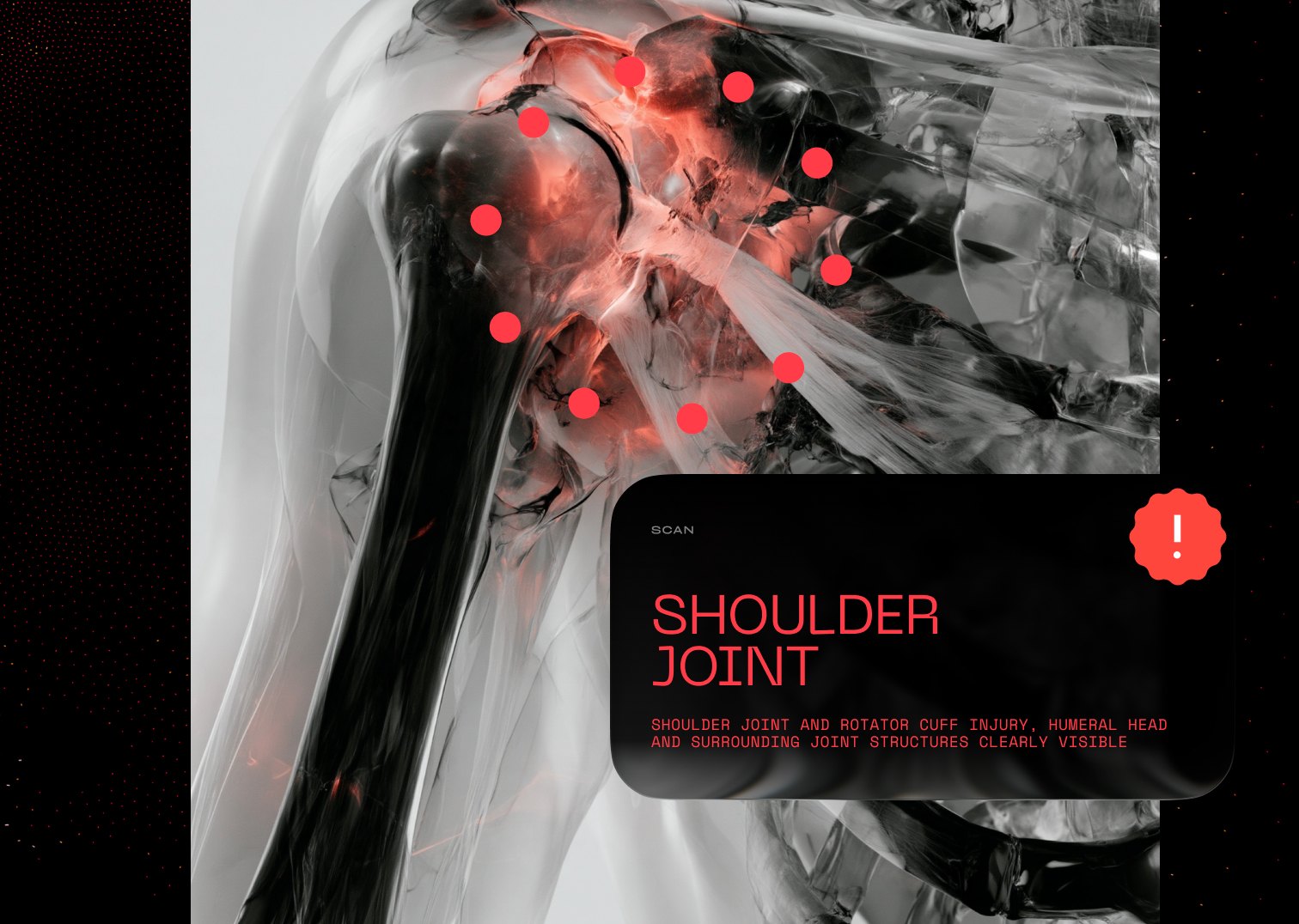 3D render of a shoulder joint with injury hotspots in red and a shoulder joint alert panel