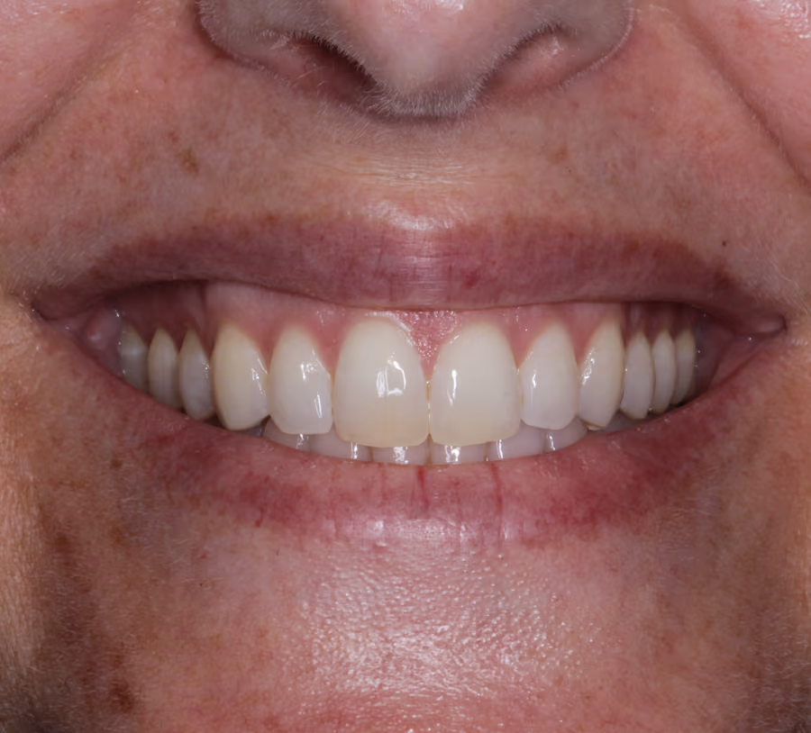 After Image