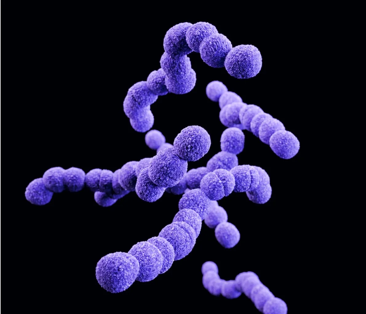 Coloured electron micrograph of Streptococcus pyogenes, showing chains of round violet cells against a black background