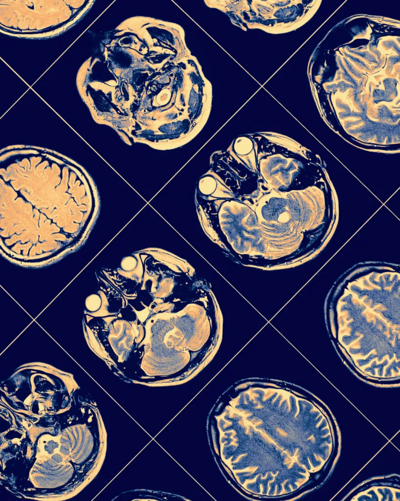 Multiple brain MRI scan images arranged in a grid pattern with detailed cross-sections.