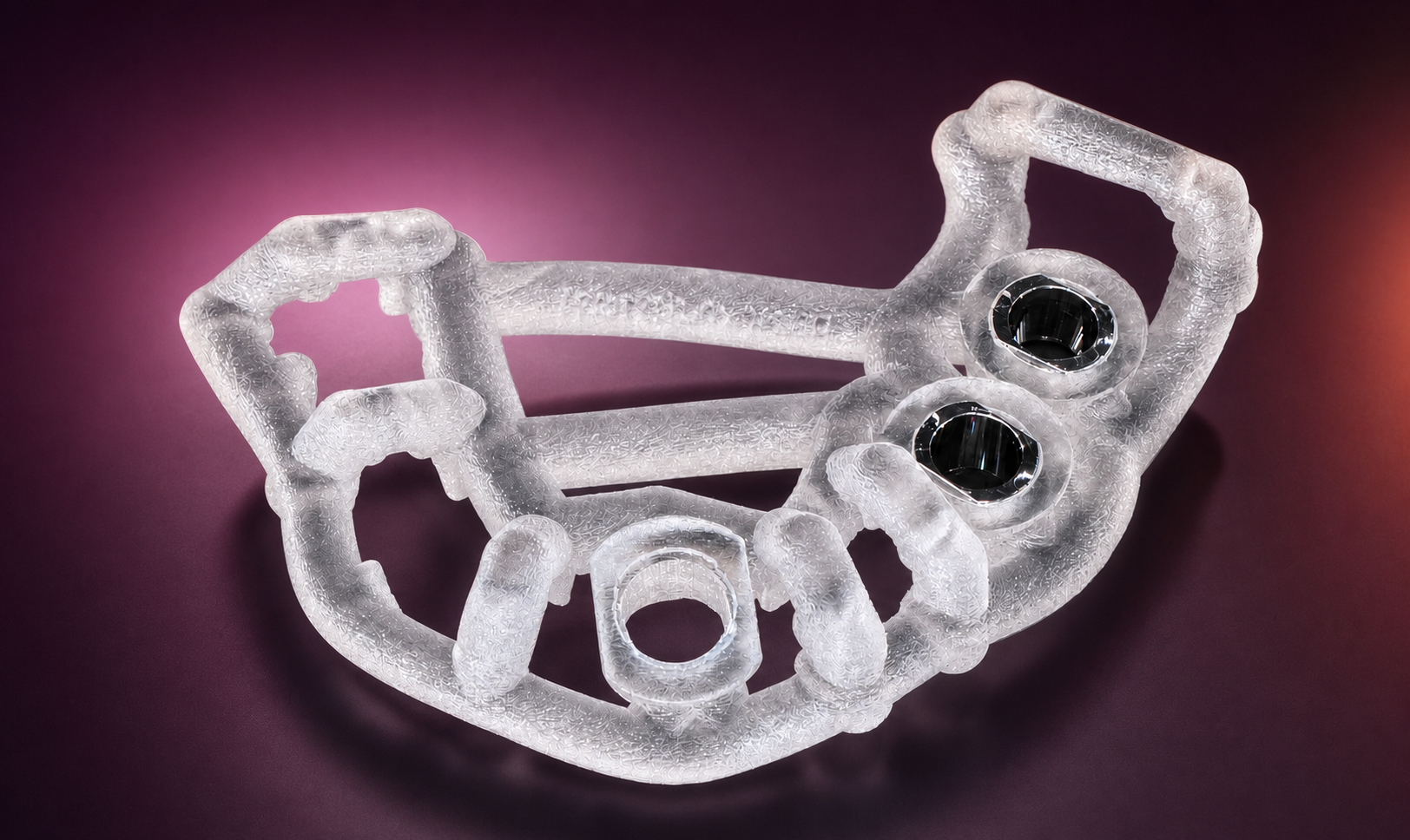 Patient-specific Smop open-frame surgical guide
