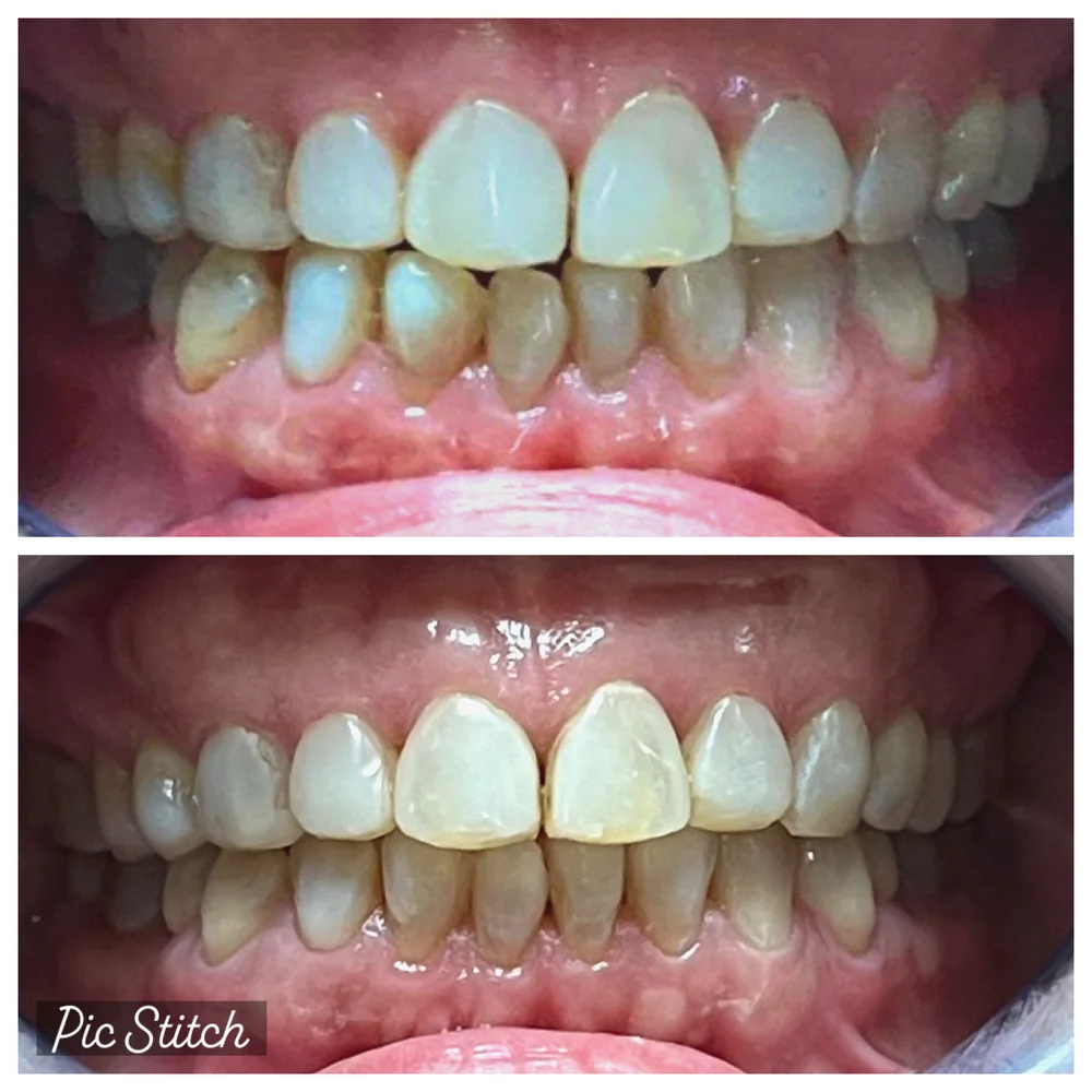 Before Image