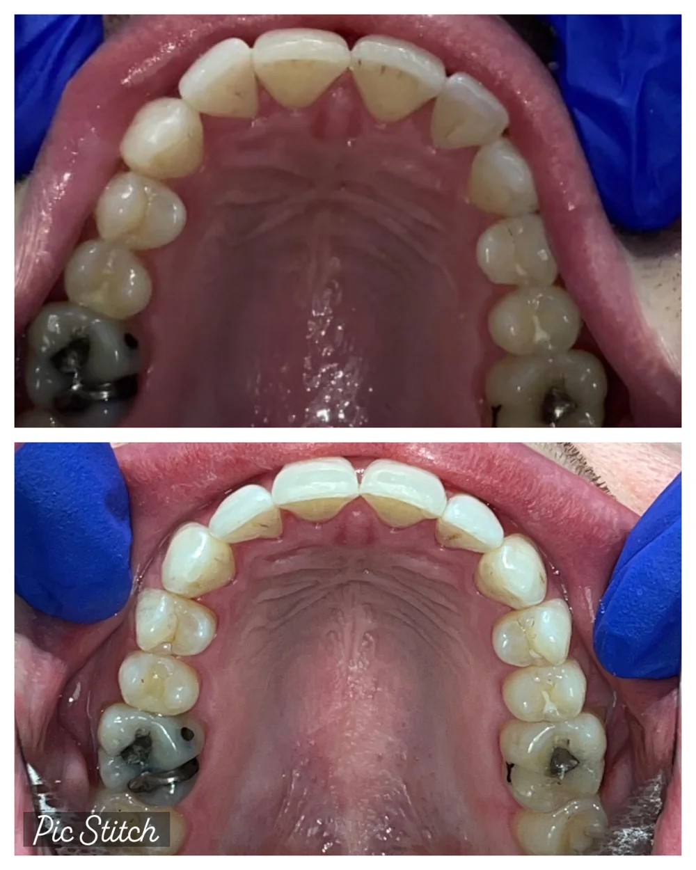 Before Image