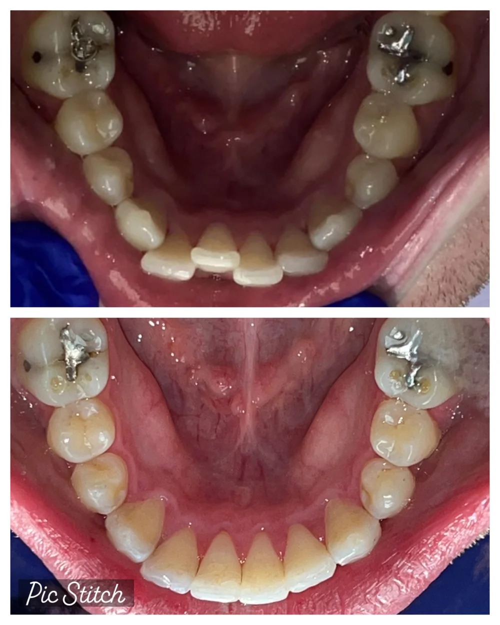 Before Image