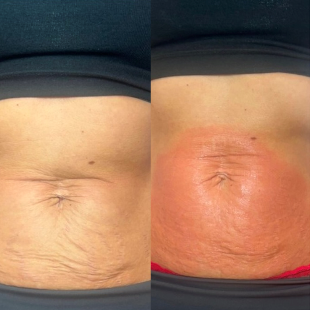 Before and after result 3