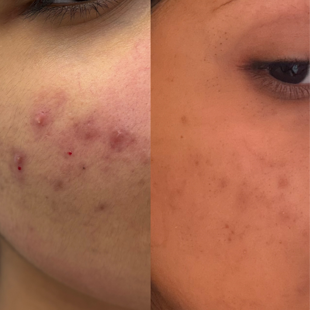 Before and after result 2