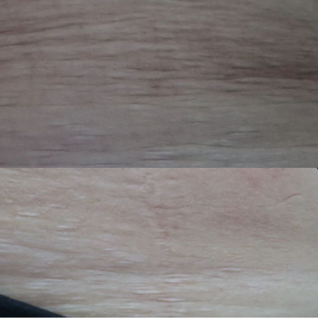 Before and after result 5