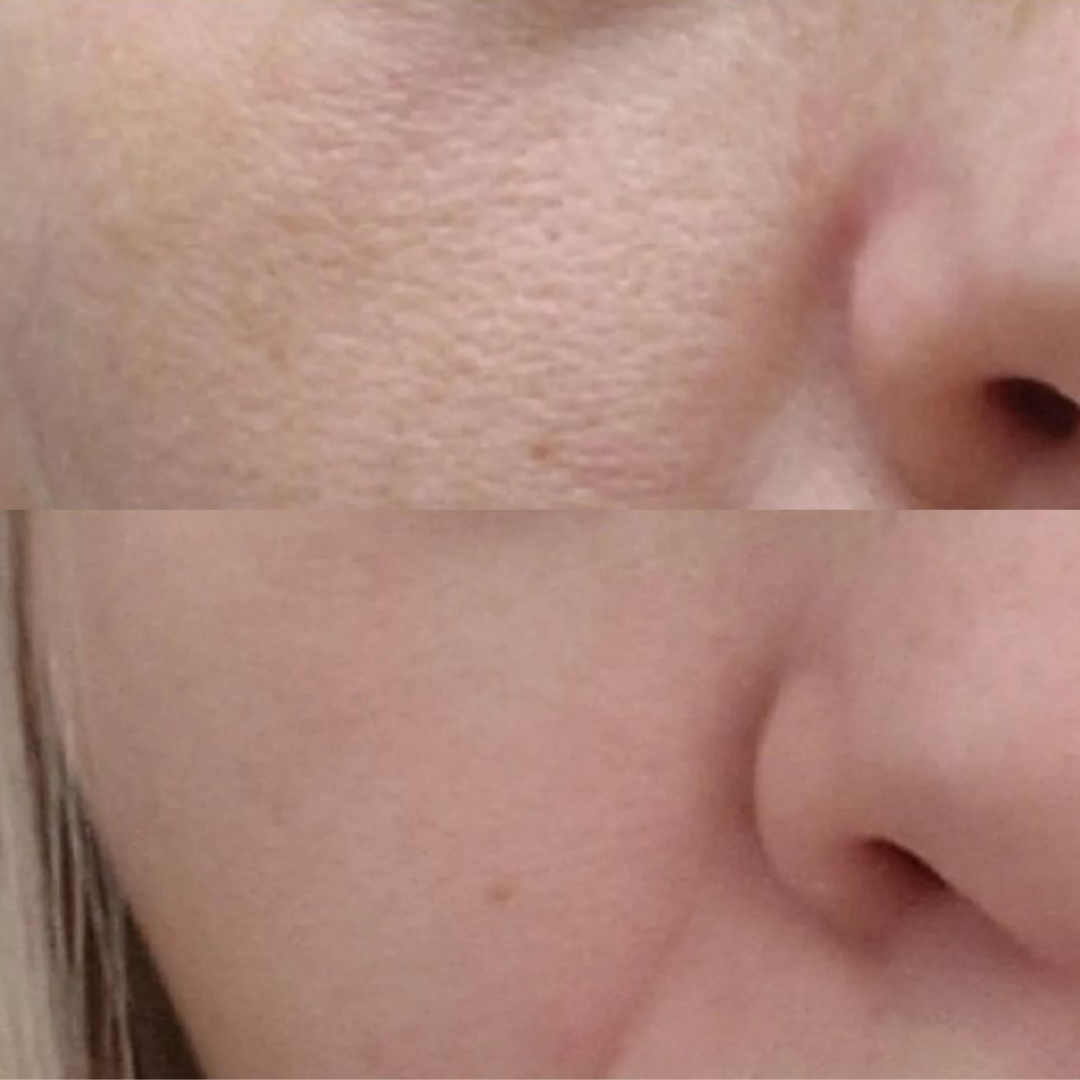 Before and after result 6