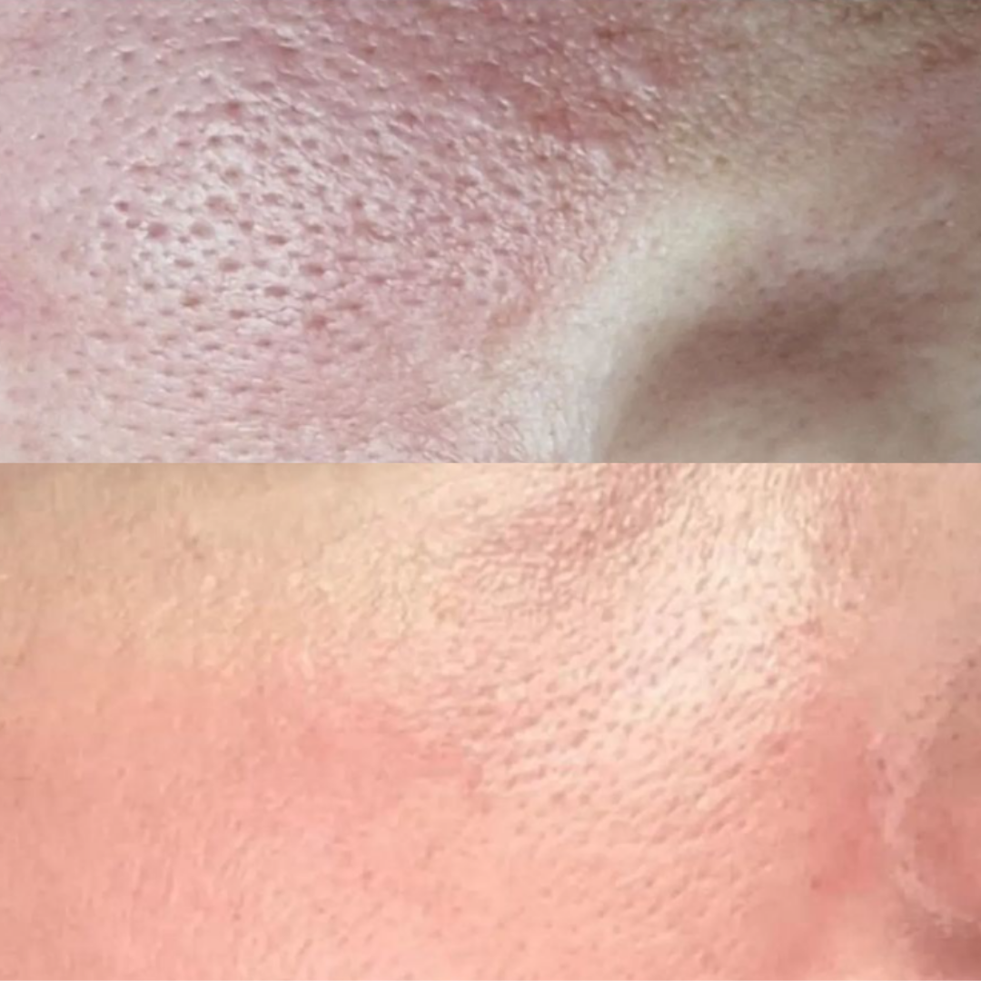 Before and after result 7